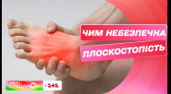 Чем опасно плоскостопие и возможно ли его вылечить – ортопед Олег Левченко